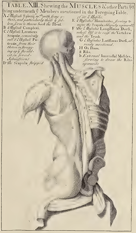 Frankenstein vs. Frankenstein